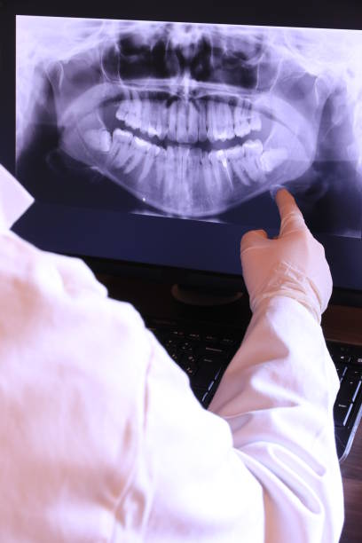 Best Emergency Tooth Extraction in Blaine, MN