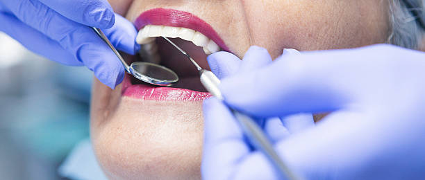 Best Emergency Treatment for Dental Infections or Abscesses in Blaine, MN